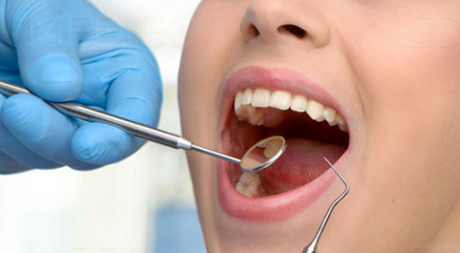 Cleaning and Prevention